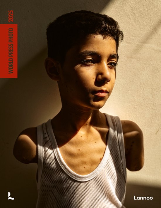 World Press Photo 2025